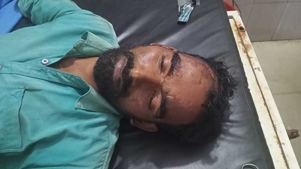 सड़क के सर्वे के दौरान पांव रपटने से खाई में गिरने से ग्राम प्रधान हुए चोटिल, टनकपुर के उपजिला अस्पताल में उपचार जारी।