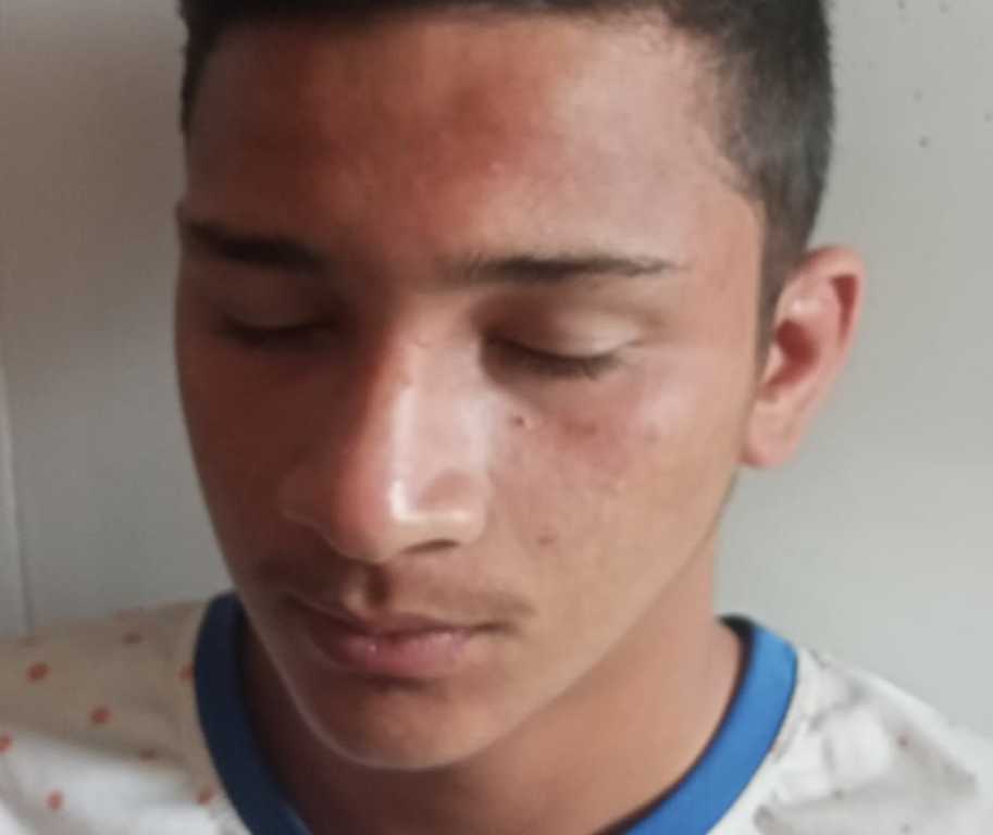 मधुमक्खियों के हमलें में किशोर घायल, उपजिला चिकित्सालय में उपचार के बाद हालत में सुधार होने पर किया डिस्चार्ज।